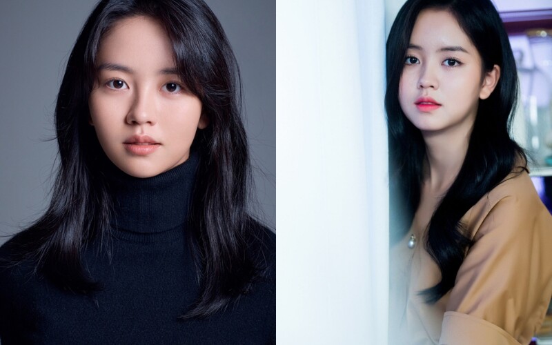 Kim So Hyun sinh năm 1999, hiện cô là một trong những nữ diễn viên nổi tiếng quen mặt trên các bộ phim truyền hình của Hàn Quốc.
