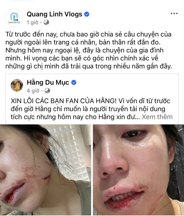 Quang Linh chia sẻ bài viết của Hằng Du Mục, lên tiếng bảo vệ cô.