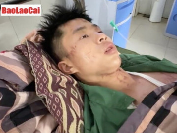 Lũ quét vùi lấp cả thôn ở Lào Cai: Lời kể người thoát chết