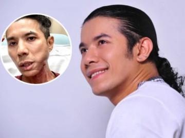 Kasim Hoàng Vũ đau đớn vì bệnh tái phát, căn bệnh của anh nguy hiểm thế nào?