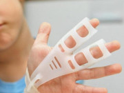 Sức khỏe - Bé gái 3 tuổi bị cửa siêu thị kẹp đứt lìa đầu ngón tay, bác sĩ chỉ cách sơ cứu để trẻ không bị tàn tật suốt đời