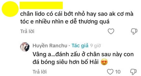 Chu Thanh Huyền đáp lời CĐM khi con trai bị soi vết bớt.