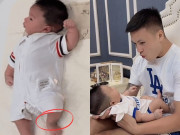Yêu con - Vợ Quang Hải đáp khéo khi con trai mới sinh bị “soi” vết bớt ở chân trái