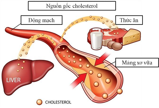 Cholesterol là một phần không thể thiếu trong cơ thể nhưng nếu quá mức, nó có thể trở thành nguy cơ lớn dẫn đến các bệnh tim mạch nghiêm trọng.
