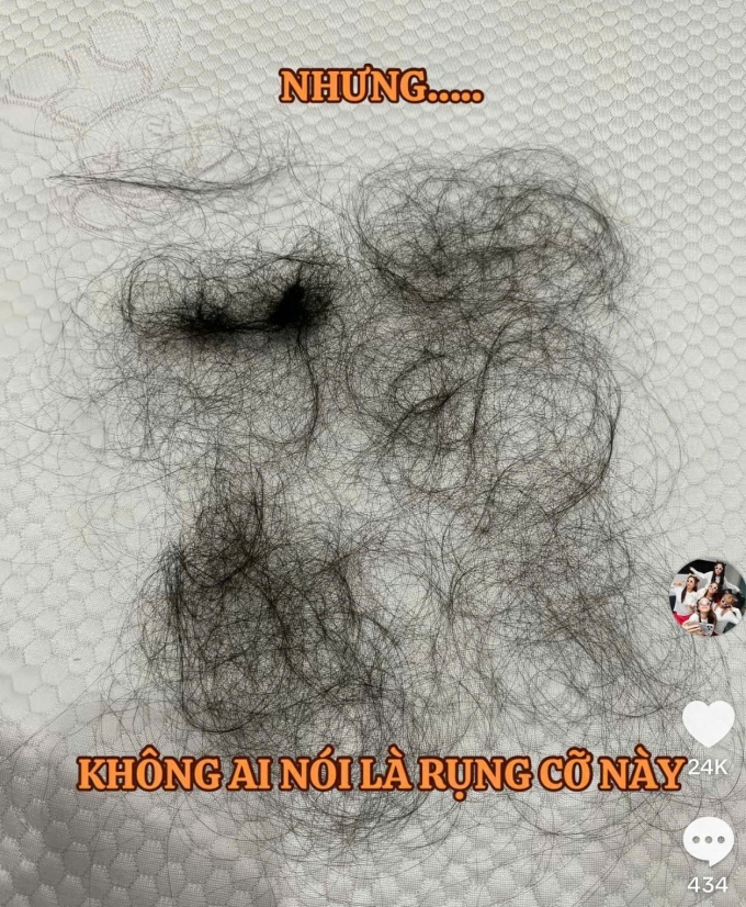 Puka tiết lộ bị rụng nhiều tóc sau khi sinh con.