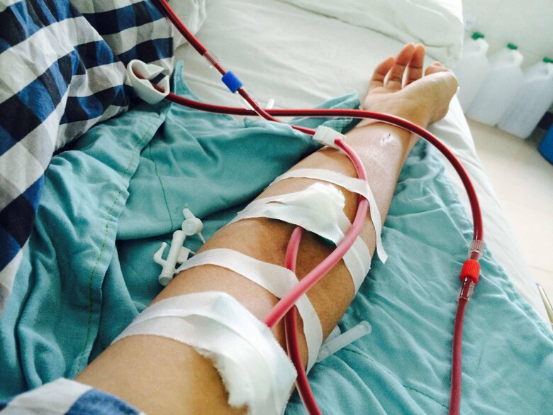 Máy lọc máu từng là hy vọng níu kéo sự sống của anh. (Ảnh: NVCC)