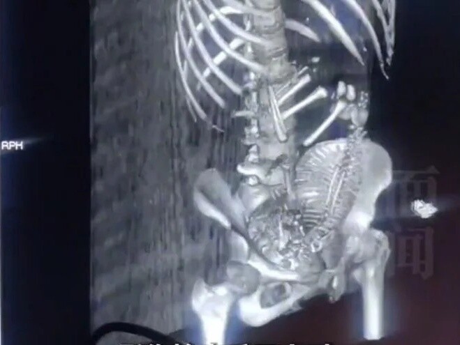 Vụ việc đã gây ra nhiều ý kiến trái chiều.