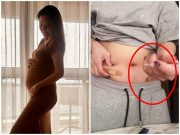 Bà bầu - Người đẹp 40 tuổi trải qua 300 mũi tiêm, đăng ảnh tự tiêm thuốc cho mình để mang thai thành công