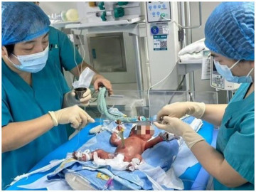 Hành trình 70 ngày giành giật sự sống của mẹ bầu có cổ tử cung bất thường