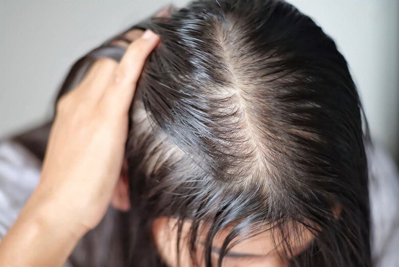 Sang thu, tốc độ tăng trưởng của tóc chậm lại nên tình trạng tóc mỏng càng rõ rệt hơn.