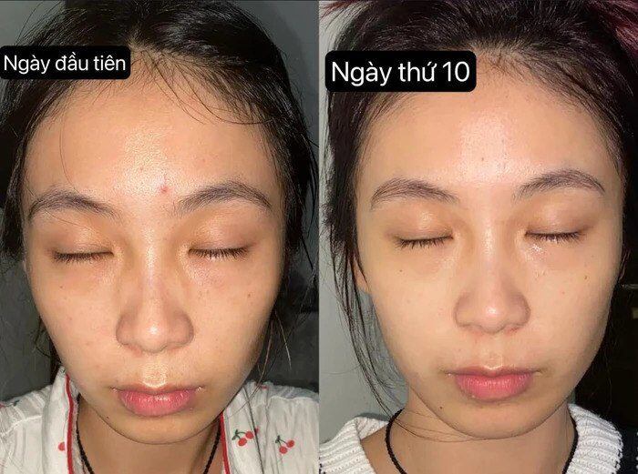 Cô nàng này vốn không có nhiều khuyết điểm trên gương mặt nhưng chỉ cần sau 10 ngày ngủ nghỉ khoa học, cô gái đã có làn da trắng sáng và rạng rỡ hơn nhiều.