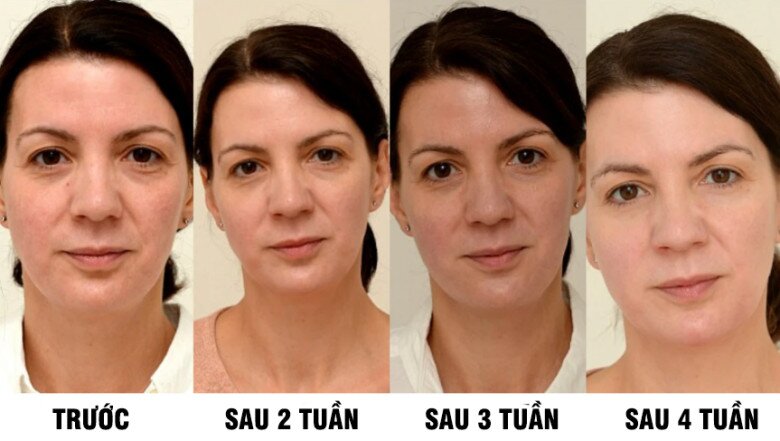 Sự thay đổi vẻ ngoài của người phụ nữ sau từng tuần.