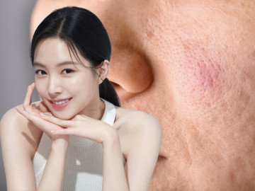 5 bước làm đẹp từ trong ra ngoài giúp xóa mờ lỗ chân lông to, tạm biệt khuôn mặt bóng loáng dầu
