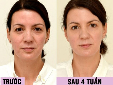 Uống loại nước rẻ tiền này mỗi ngày, người phụ nữ U45 đẹp lên không tưởng chỉ sau 1 tháng, làn da như được tái sinh hoàn toàn