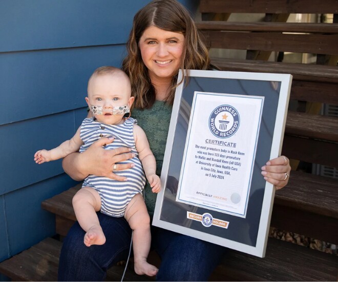 Em bé amp;#34;hạt tiêuamp;#34; sinh non nhất thế giới, nặng chưa đầy 3 lạng giờ ra sao? - 1