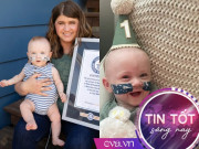 Tin tức - Em bé "hạt tiêu" sinh non nhất thế giới, nặng chưa đầy 3 lạng giờ ra sao?