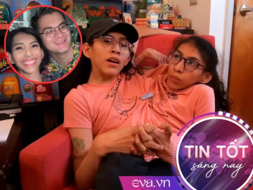 Cặp song sinh dính liền từng được chẩn đoán không sống nổi 3 ngày giờ ra sao?