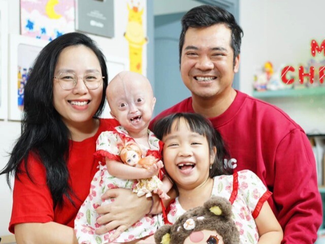 Cuộc sống đặc biệt của bé mắc bệnh hiếm nhất Việt Nam