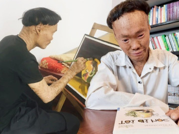 Gặp người cá vẽ tranh bằng da, biến nghịch cảnh thành động lực, luôn khát khao một tổ ấm của riêng mình