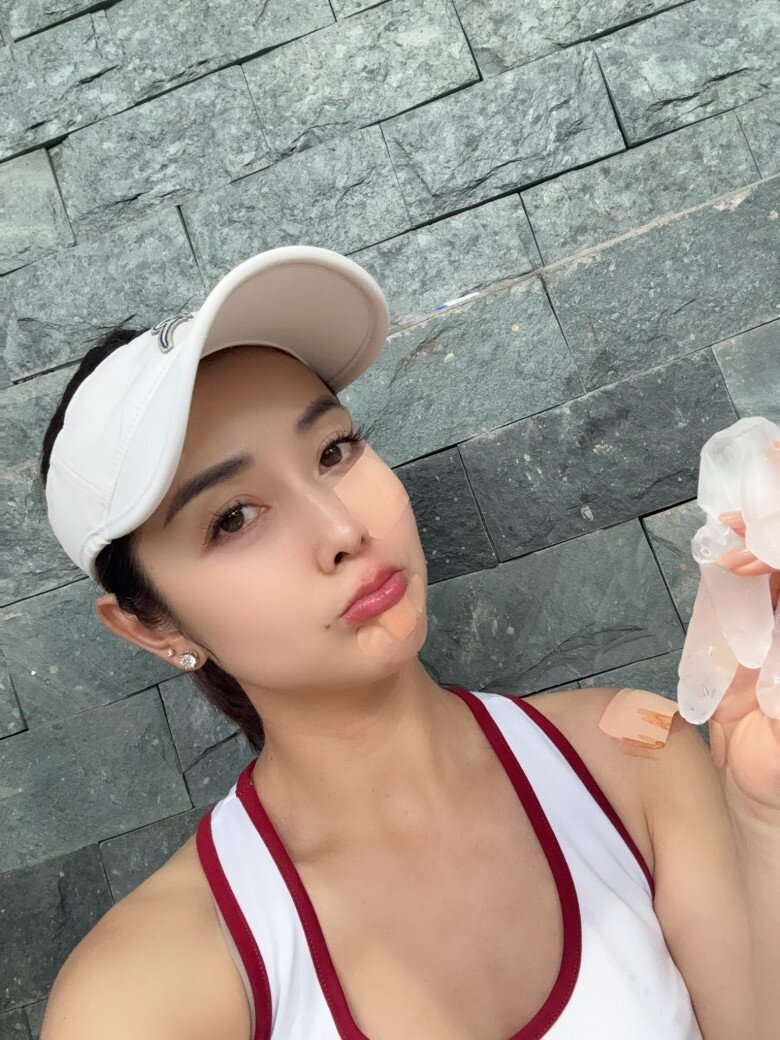 Nhiều khán giả lo lắng, động viên người đẹp sớm lành vết thương.