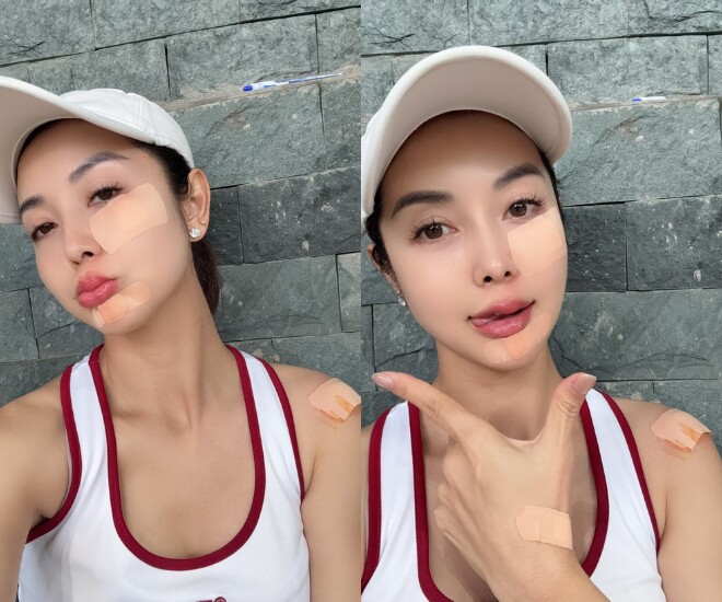 Hoa hậu Jennifer Phạm bị ngã khi chơi pickleball, chấn thương cả tay, chân và mặt.