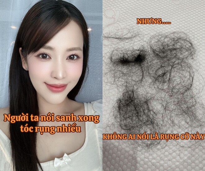 Puka rụng nhiều tóc sau khi sinh con đầu lòng.