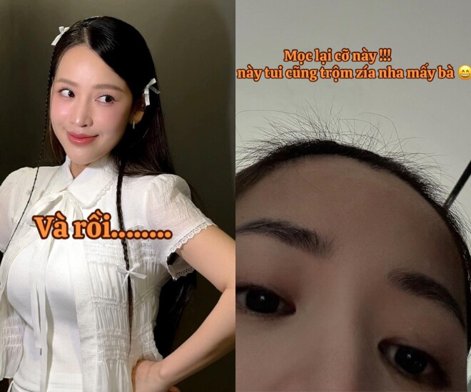 Mái tóc mọc lởm chởm của nữ diễn viên khiến dân tình vừa thương vừa buồn cười.