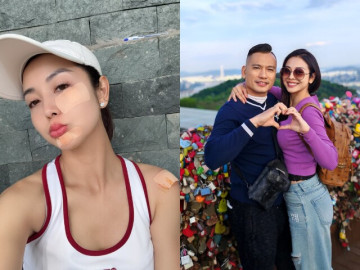 Hoa hậu Jennifer Phạm trầy hết nửa mặt vì ngã khi chơi pickleball, dân mạng bày tỏ không phải chồng mà nhìn còn xót