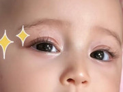 Yêu con - Bé gái sơ sinh có khuôn mặt đẹp như tiên tử, cõi mạng trầm trồ “đứa trẻ đã phẫu thuật thẩm mỹ”