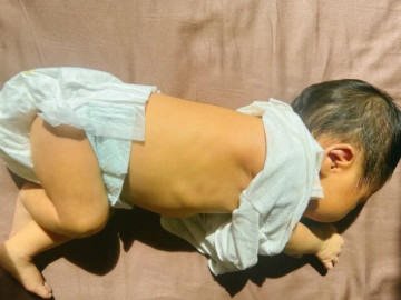 Bác sĩ đề nghị điều trị vàng da cho cháu sơ sinh nhưng bà nội kiên quyết từ chối, 1 tháng sau cả gia đình suy sụp