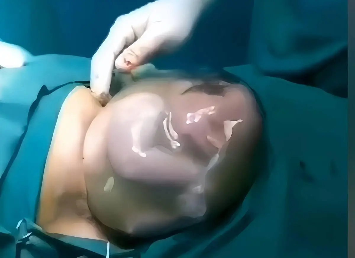 Lấy vợ là bạn thân đại học, chồng nằng nặc đòi vào phòng mổ đẻ và cái kết hốt hoảng khi lần đầu nhìn thấy em bé - 2