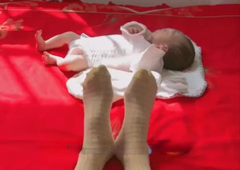 Sản phụ thừa nhận hối hận với lựa chọn của mình, hiện tại cứ trời trở lạnh là cơ thể cô đau nhức.