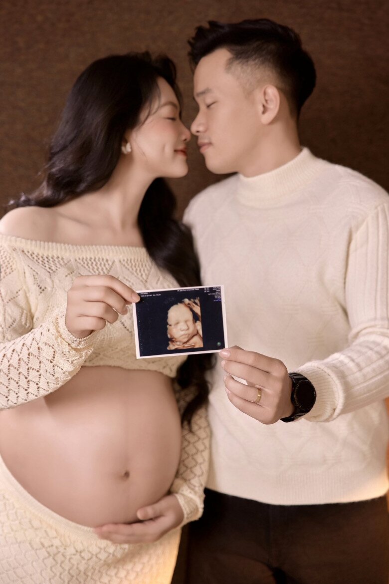 Vợ chồng Thu Hoài khoe ảnh siêu âm của nhóc tỳ sắp chào đời.