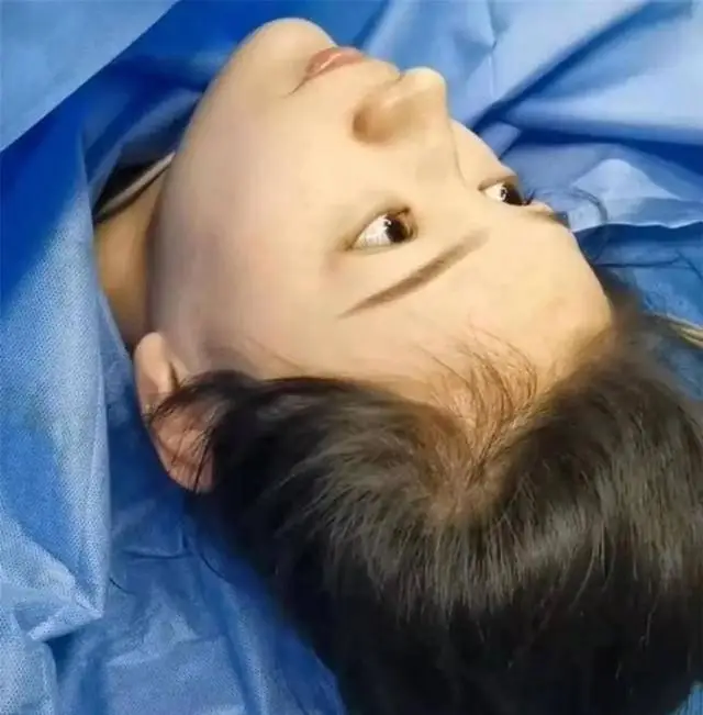 Sản phụ sở hữu các đường nét thanh tú.