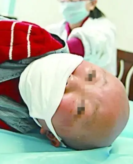 Một trong hai bé bị bệnh bạch cầu, cần ghép tuỷ để duy trì sự sống - Ảnh minh hoạ.