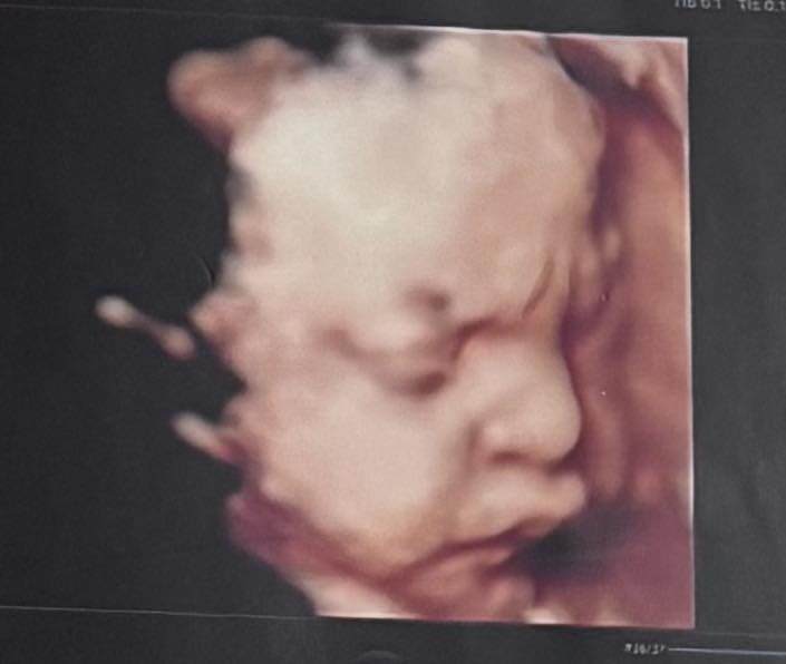 Lê Thu Trang chia sẻ ảnh siêu âm cận mặt thai nhi.