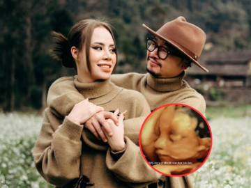 Cưới học trò kém 15 tuổi, một   anh tài   Vbiz sắp đón con đầu lòng ở tuổi 41, ảnh siêu âm hé lộ visual trộm vía của nhóc tỳ