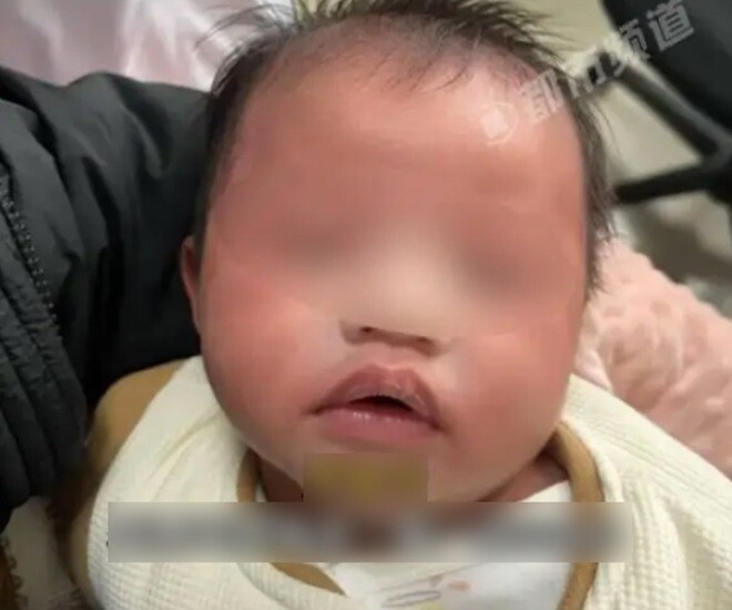 Bé sơ sinh 1 tháng tuổi nhập viện khẩn cấp vì bà nội dùng thứ nước này để pha sữa cho cháu - 1