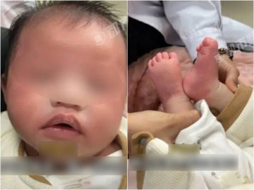 Bé sơ sinh 1 tháng tuổi nhập viện khẩn cấp vì bà nội dùng thứ nước này để pha sữa cho cháu