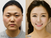 Đẹp - Chồng rút đơn ly hôn vì vợ "lột xác" ngoạn mục sau phẫu thuật thẩm mỹ, lời khuyên cho hội chị em có ý định "dao kéo"