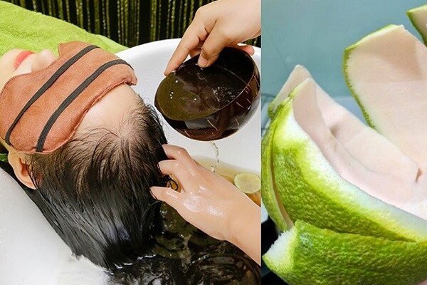 Từ chuyện Puka rụng tóc cả nắm sau sinh, dân tình chỉ ngay 5 bí quyết dân gian giúp mọc tóc từ loạt amp;#34;thần dượcamp;#34; vừa rẻ vừa hiệu quả - 3
