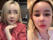 "Trái đắng" của các mỹ nhân Việt khi sửa mũi: Đệ nhất dao kéo làm hơn chục lần vẫn chưa ưng, một người biến chứng nặng sau 12 năm