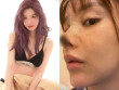 Mỹ nhân gợi cảm bị hoại tử, rụng chóp mũi vì gặp biến chứng thẩm mỹ kinh hoàng nhất showbiz, "mất trắng" 7 tỷ đồng
