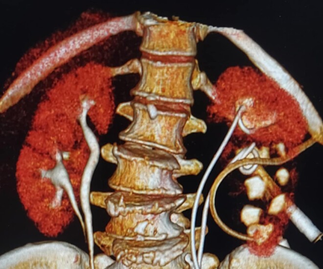 Hình ảnh phim chụp của người bệnh. Ảnh: BSCC.