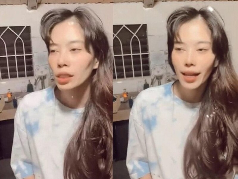 Trong khi Nam Anh gây ấn tượng với nhan sắc bừng sáng, Nam Em lại tều tụy, đường nét gương mặt thay đổi nhiều so với trước đây. Nhiều người nhận xét không nhận ra cả 2 là chị em song sinh.