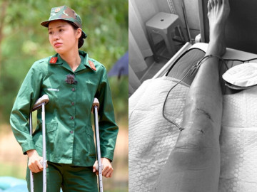 Siêu mẫu Minh Tú chấn thương nghiêm trọng, bác sĩ lên tiếng cảnh báo