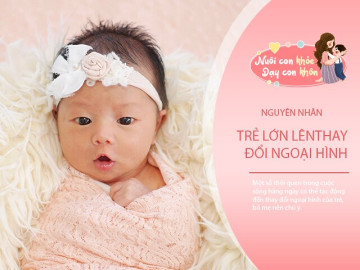 Trẻ xinh đẹp lúc nhỏ nhưng vỡ nét khi lớn lên: Bác sĩ nói bố mẹ đã nuôi dạy sai cách