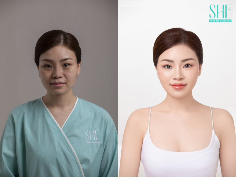“Chạm đến vẻ đẹp tự tin” – Phẫu thuật thẩm mỹ SHE, nơi phụ nữ tìm lại chính mình - 4