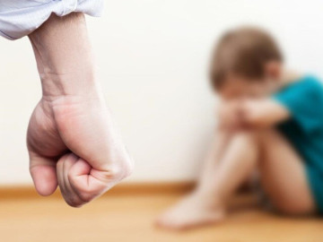 Điều tra vụ bé 4 tuổi nghi bị giáo viên mầm non đánh bầm tím mặt