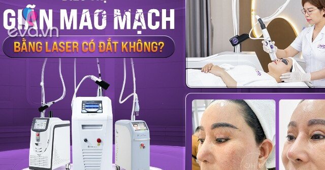 Điều trị giãn mao mạch bằng laser có đắt không?